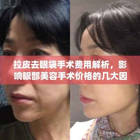 拉皮去眼袋手术费用解析,影响眼部美容手术价格的几大因素